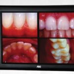 Multimedia Kit Standard